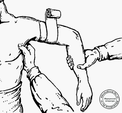 Положение верхней конечности при наложении повязки на плечо