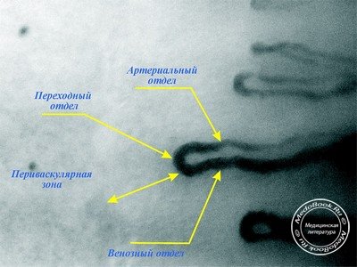 Изображение капилляроскопии