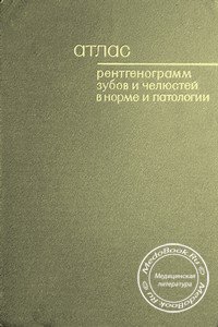 Обложка книги «Атлас рентгенограмм зубов и челюстей в норме и патологии», изданной под редакцией Шехтера И.А. в 1968 году