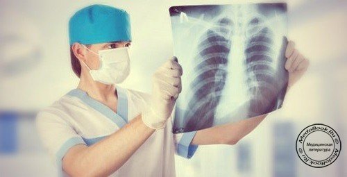 Рентгенологическая диагностика отека легких
