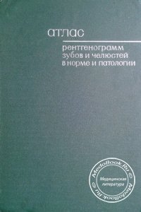 Атлас рентгенограмм зубов и челюстей в норме и патологии, Шехтер И.А., 1968 г.