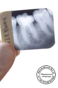 Особенности рентгенографии зубов