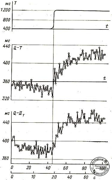Графики переходных процессов изменения продолжительности систолы при скачкообразном изменении частоты сердечного ритма