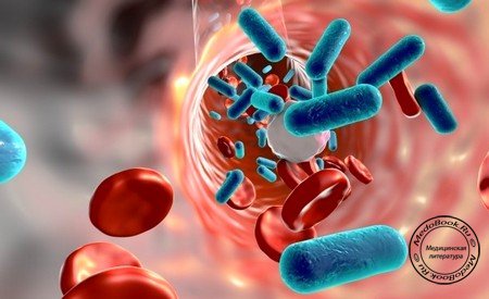 Бактерии в крови - причина сепсиса
