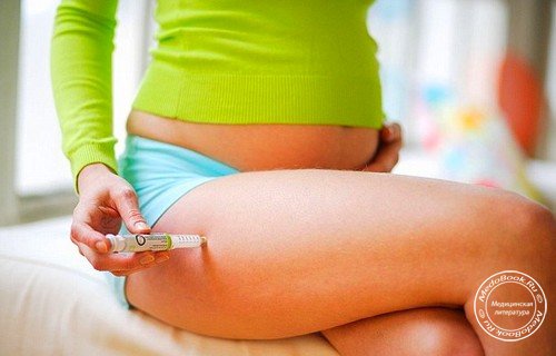 Инсулинотерапия при диабете беременных