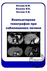 Обложка книги «Компьютерная томография при заболеваниях печени» Китаева В.М., изданной в 2006 году