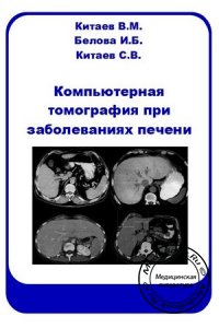 Компьютерная томография при заболеваниях печени, Китаев В.М., 2006 г.