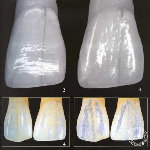 Основные компоненты структуры поверхности зуба