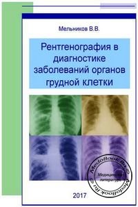 Обложка книги «Рентгенография в диагностике заболеваний органов грудной клетки» Мельникова В.В., изданной в 2017 году