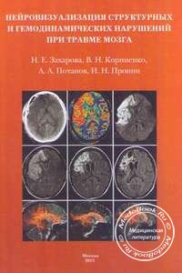 Обложка книги «Нейровизуализация структурных и гемодинамических нарушений при травме мозга» Захаровой Н.Е., изданной в 2013 году