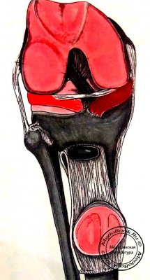 Связки коленного сустава (надколенник отогнут)